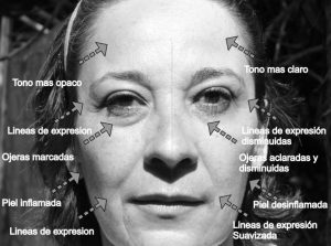 cara comparativa facial antes/después